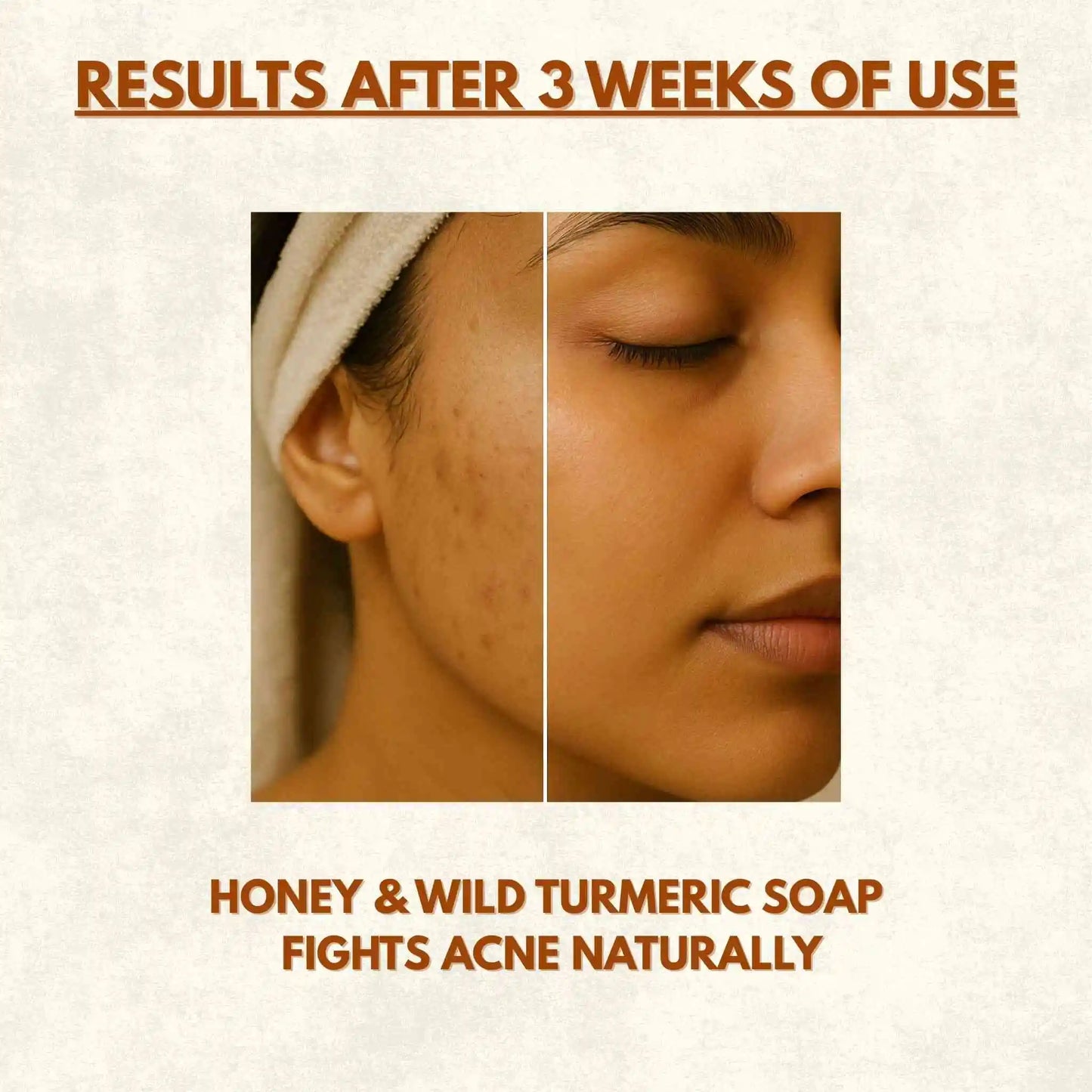 Honey & Wild Turmeric Golden Glow Soap | 100g