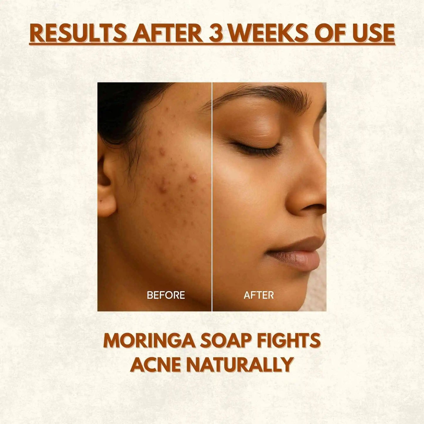 Moringa Green Radiance Soap | 100g